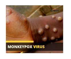 Ogun confirms 4 Monkeypox cases